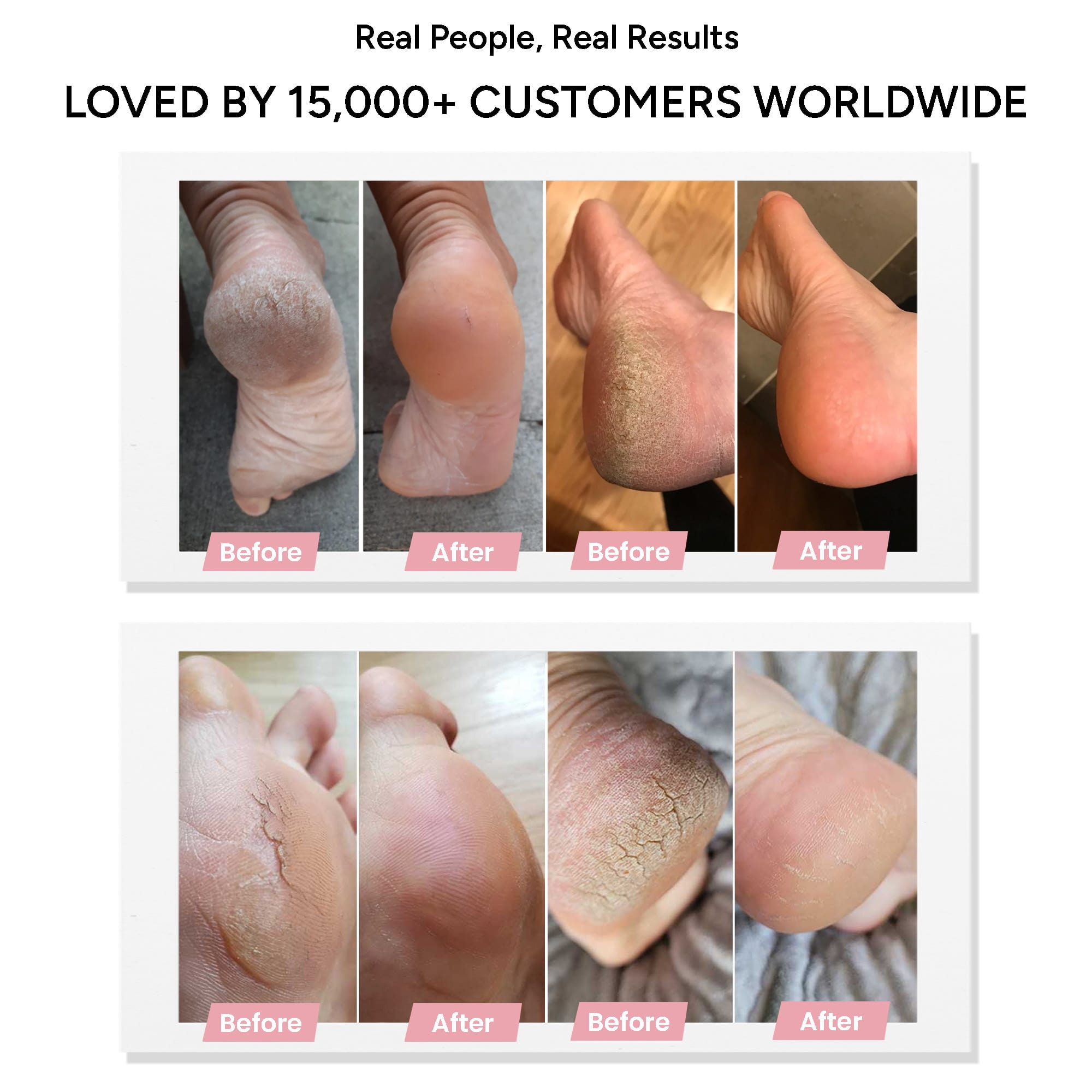 Pedicuure™ Electric Foot Callus Remover